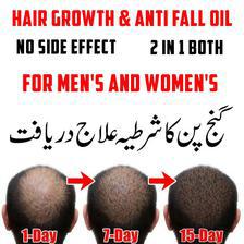 Hair Loss , Hair growth and Regrowth - Pure Hair Oil 100% Working