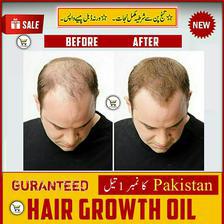 Hair Growth No More Hair Loss & Repair Essential Oil Hair Growth Hair Loss Treatment Hair Growth oil for Men and Women