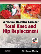A Practical Operative Guide for Total Knee and Hip Replacement with DVD-ROM