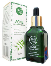 Rivaj UK Acne Treatment Serum 30 ml
